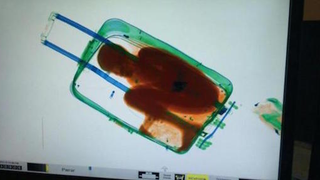 X-ray photos reveal child being smuggled was hidden inside a suitcase